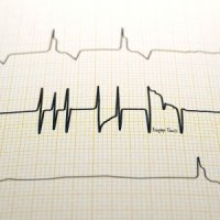 ВАДЯРА БЛЮЗ - ВВЕРХ